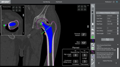 Mako Total Hip | Stryker